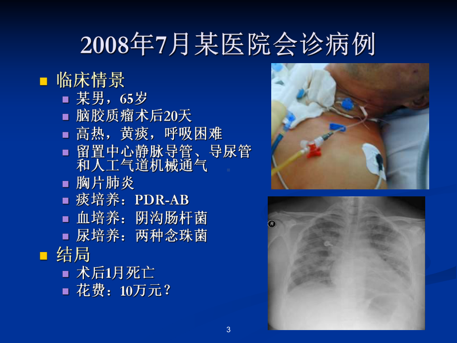 ICU与医院感染预防教案课件.pptx_第3页