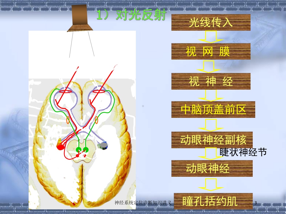 神经系统定位诊断知识讲义培训课件.ppt_第3页