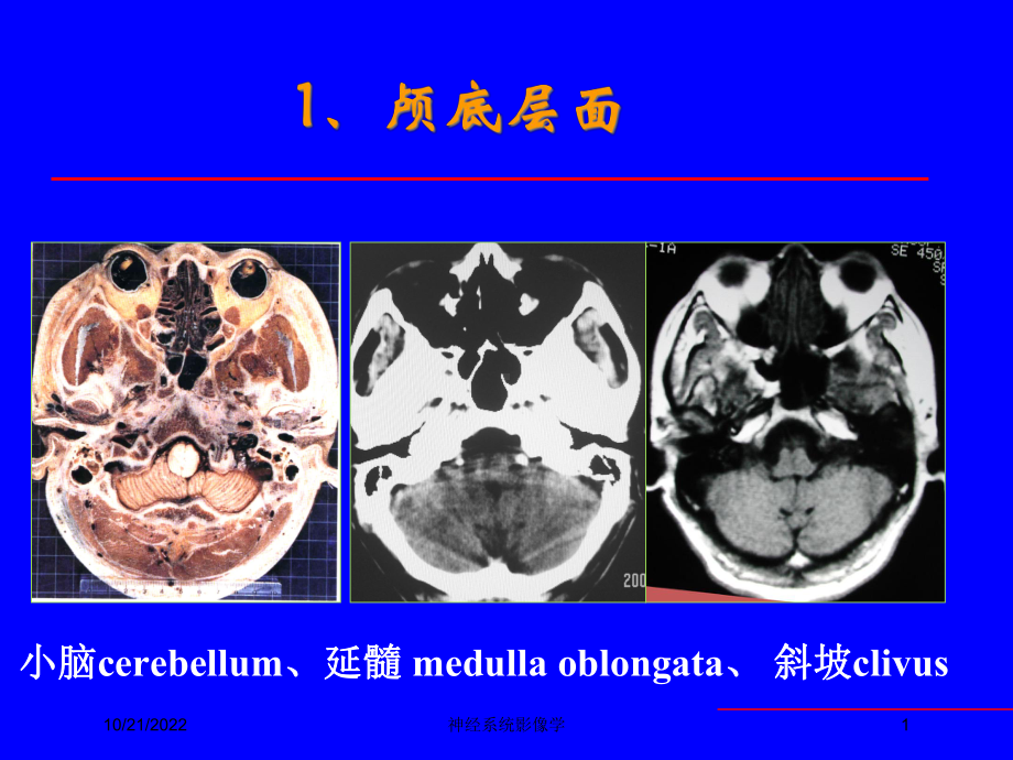 神经系统影像学培训课件.ppt_第1页