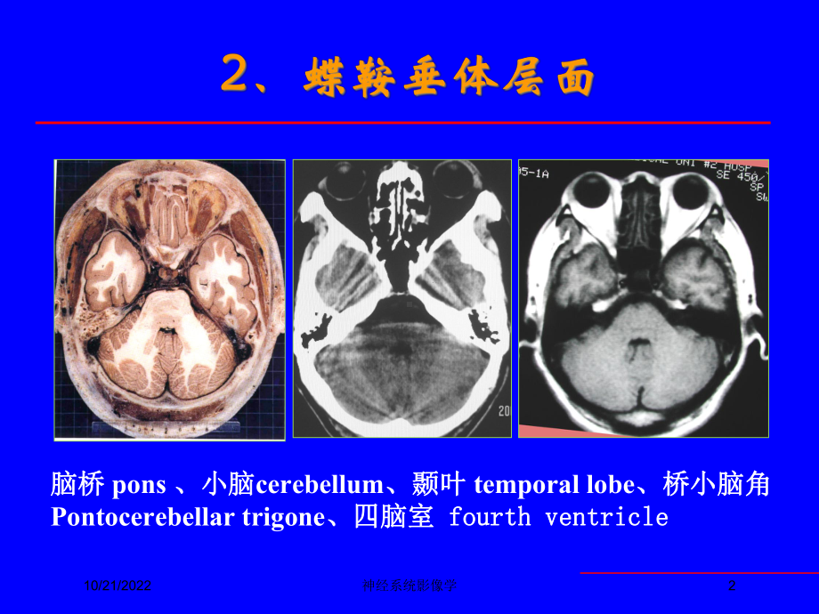 神经系统影像学培训课件.ppt_第2页