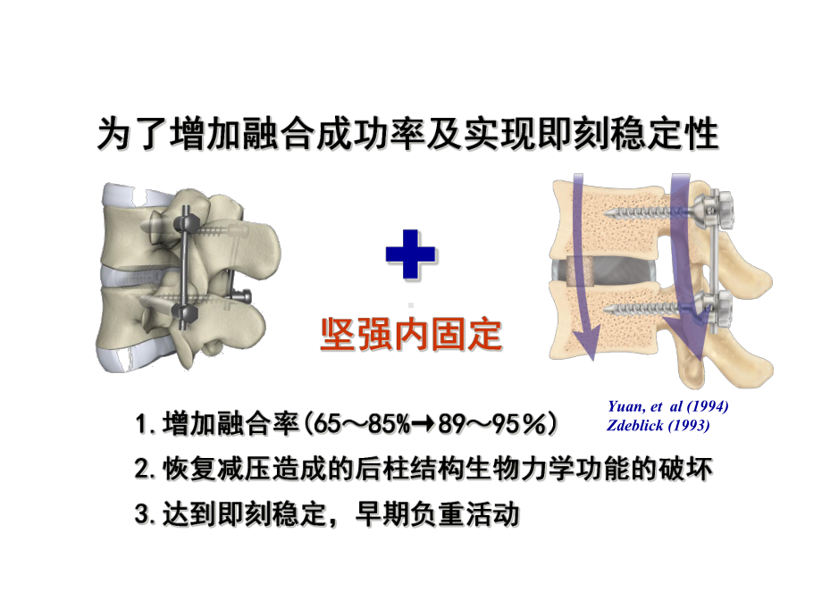 DYNESYS在腰椎退行性病变中的应用课件.ppt_第2页