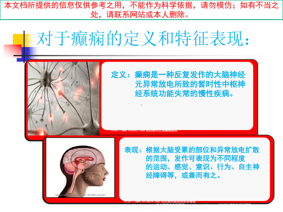 癫痫医疗护理和急救培训课件.ppt_第2页