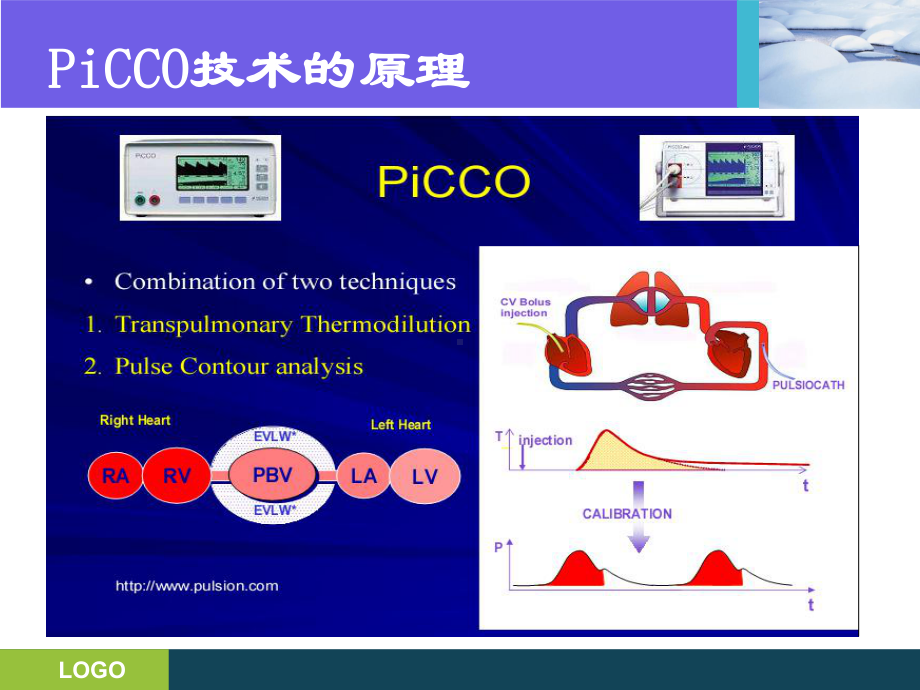 PICCO技术详解复习过程课件.ppt_第3页