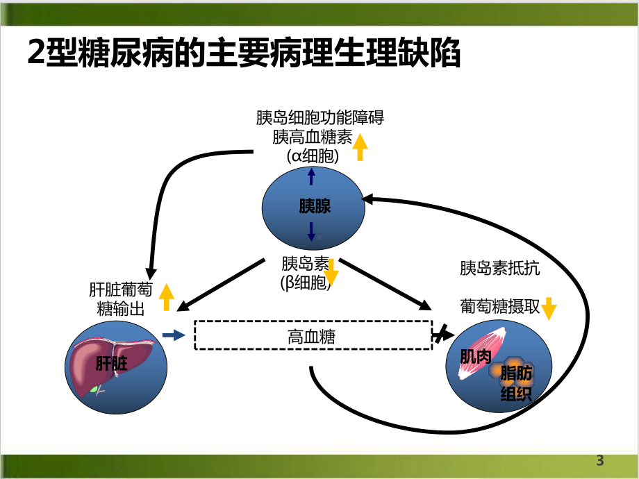 糖尿病非胰岛素治疗示范课件.ppt_第3页