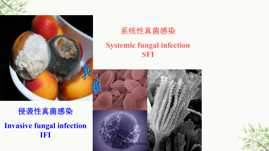 真菌感染的基础和临床课件.ppt_第2页