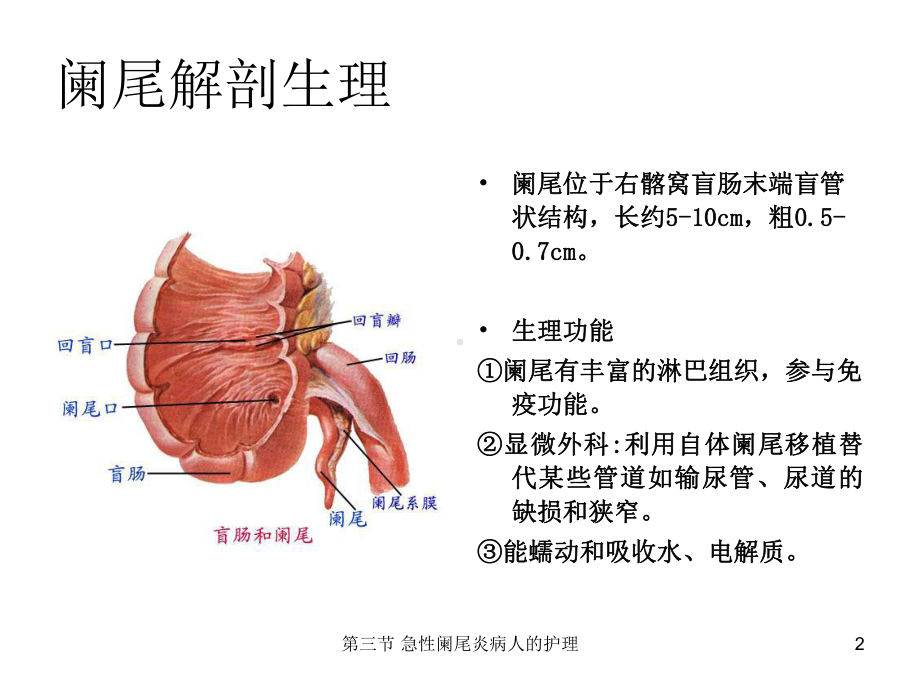 第三节-急性阑尾炎病人的护理课件.ppt_第2页