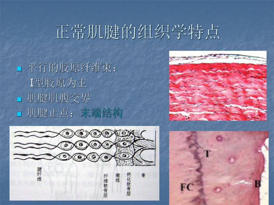 肌腱断裂医学课件.ppt_第2页