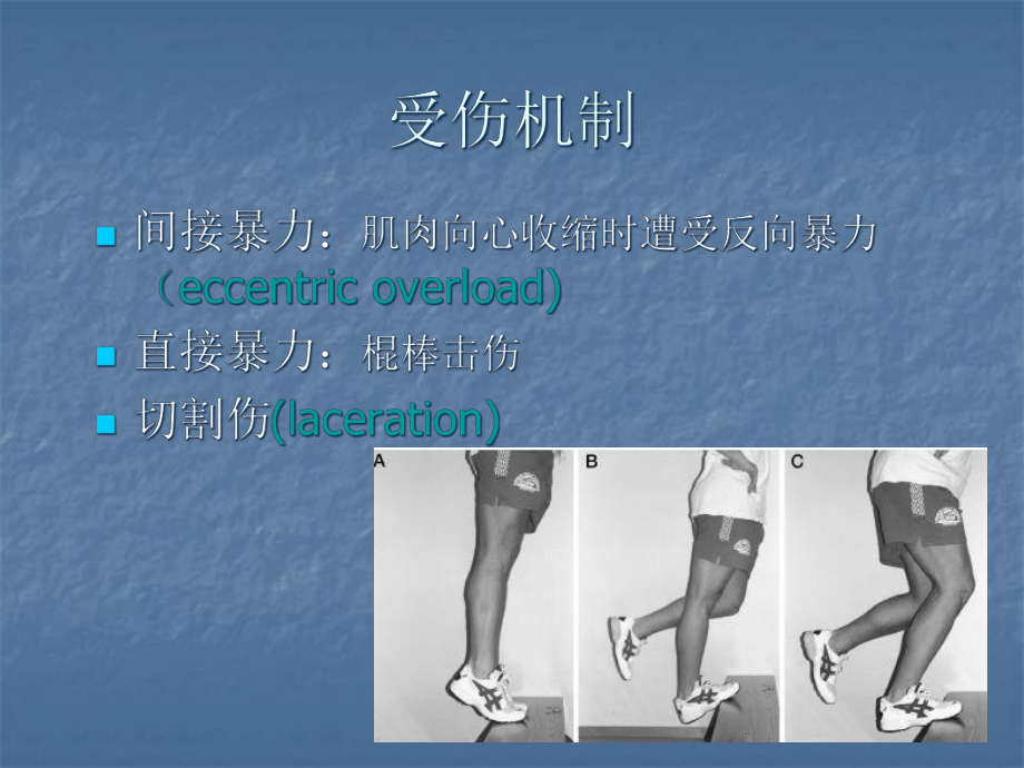 肌腱断裂医学课件.ppt_第3页