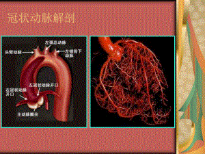 经桡动脉冠脉造影主题讲座课件.ppt