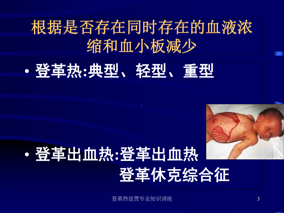 登革热宣贯专业知识讲座培训课件.ppt_第3页