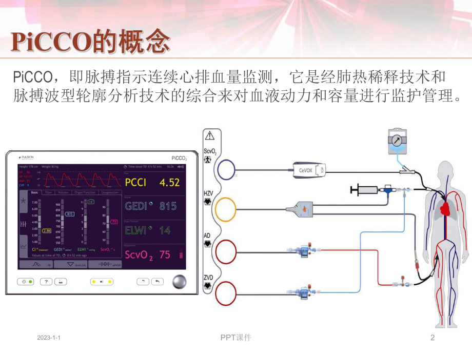 PiCCO快速入门-课件.ppt_第2页