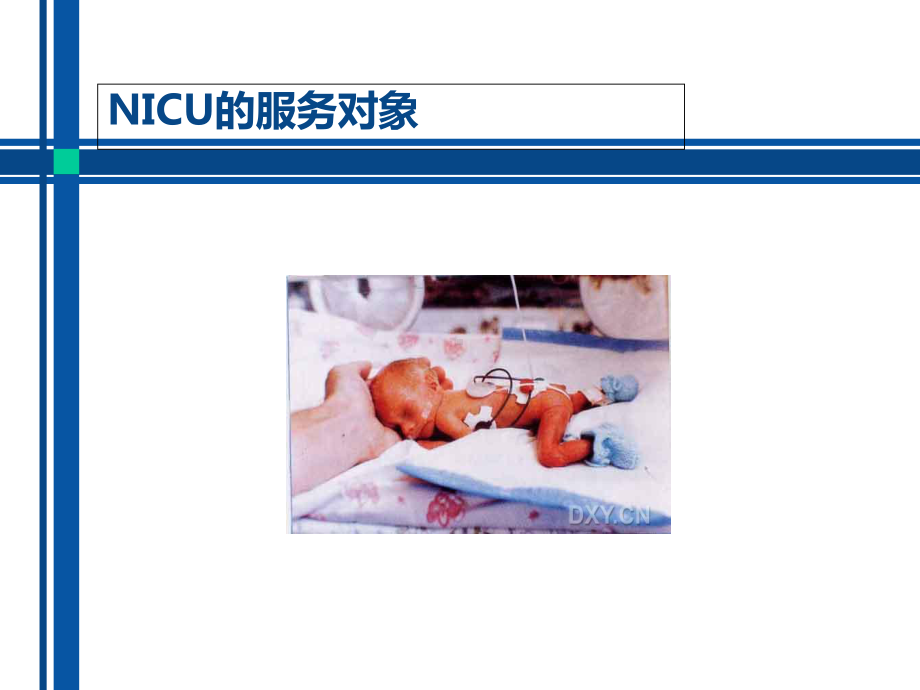 NICU的三个一课件.ppt_第3页