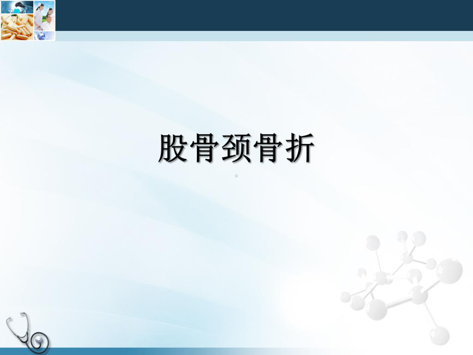 粗隆间骨折教材课件.ppt_第3页