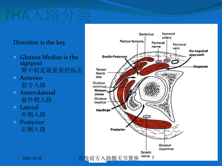 直接前方入路髋关节置换培训课件.ppt_第2页