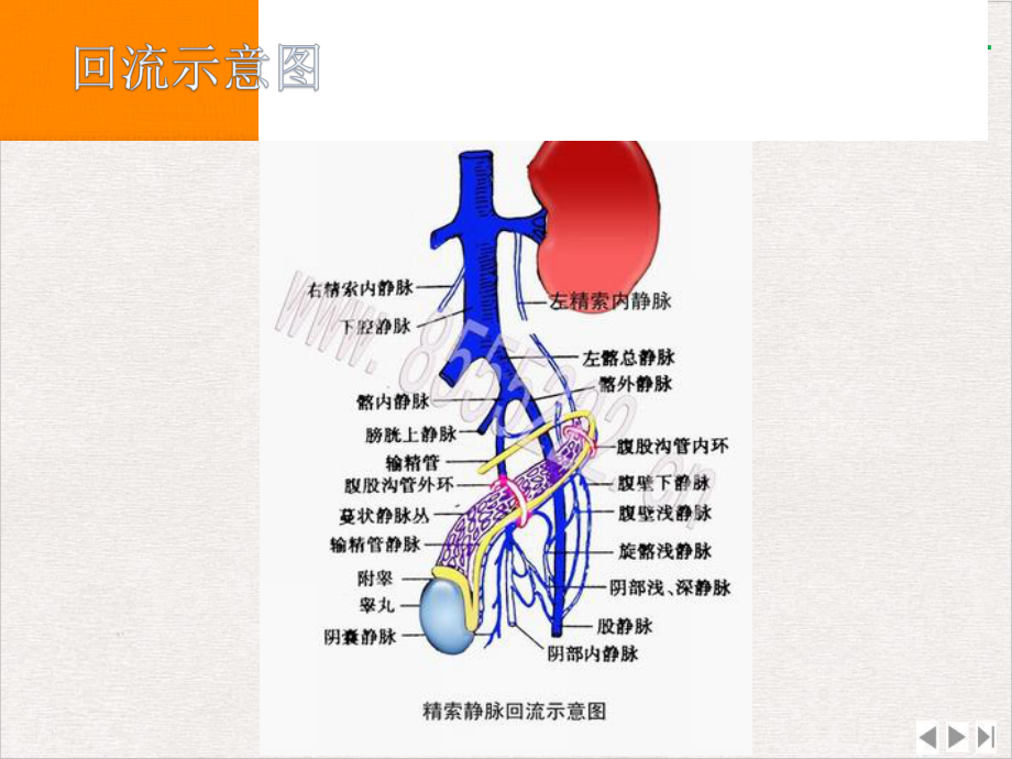 精索静脉曲张及胡桃夹综合征实用版课件.pptx_第3页