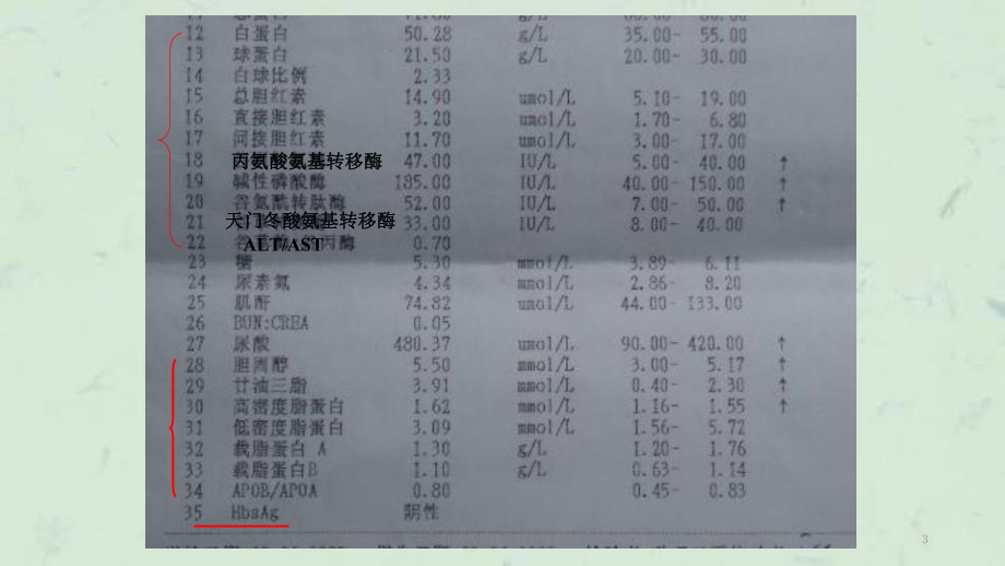 肝脏病常用实验室检查课件.ppt_第3页