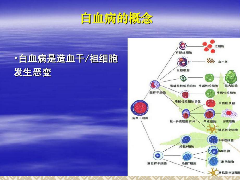 白血病的分型专题宣讲培训课件-2.ppt_第2页