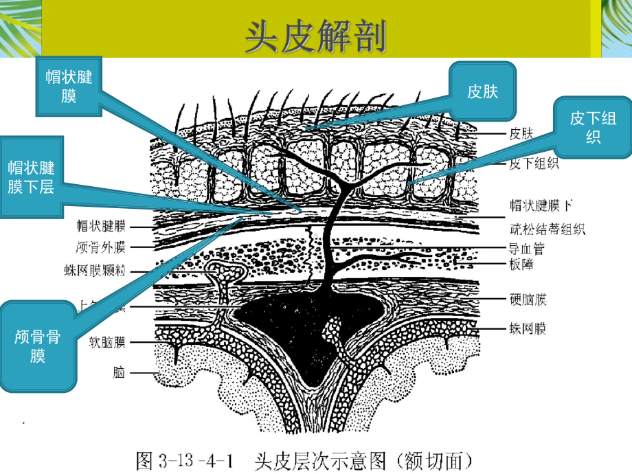 第十章颅脑损伤病人的护理最全课件.ppt_第2页