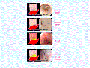 上消化道内镜诊断规范课件.ppt