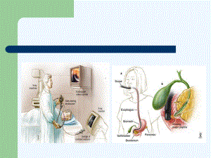 ERCP及术前术后护理课件.ppt