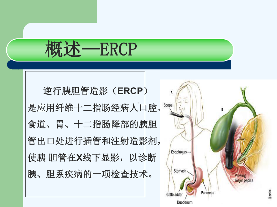 ERCP及术前术后护理课件.ppt_第3页