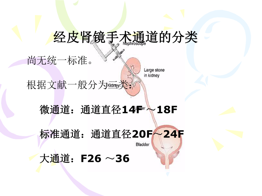 经肾上盏入路微创经皮肾镜取术医学课件.ppt_第2页