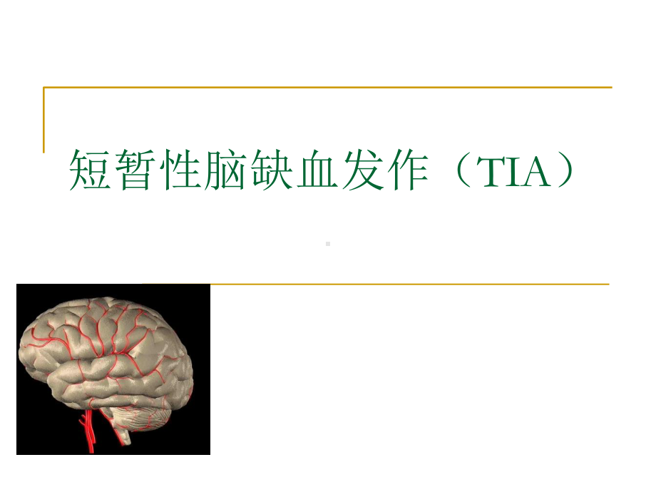 TIA-短暂性脑缺血发作课件.ppt_第1页