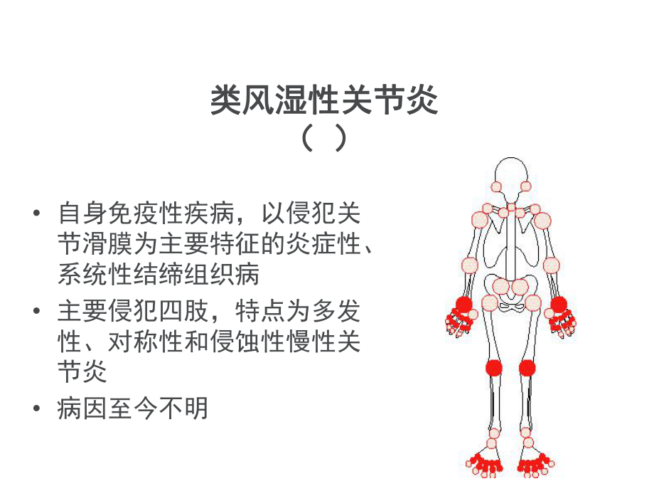 类风湿性炎影像学诊断课件.ppt_第2页