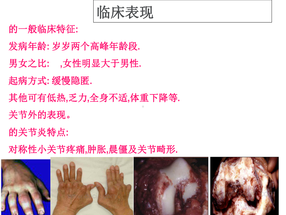 类风湿性炎影像学诊断课件.ppt_第3页