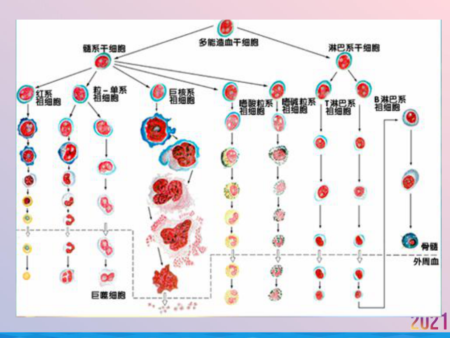 白血病课件定稿2021推荐.ppt_第3页