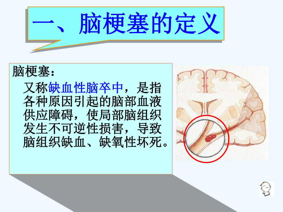 神经内科脑梗塞护理查房课件.ppt_第2页