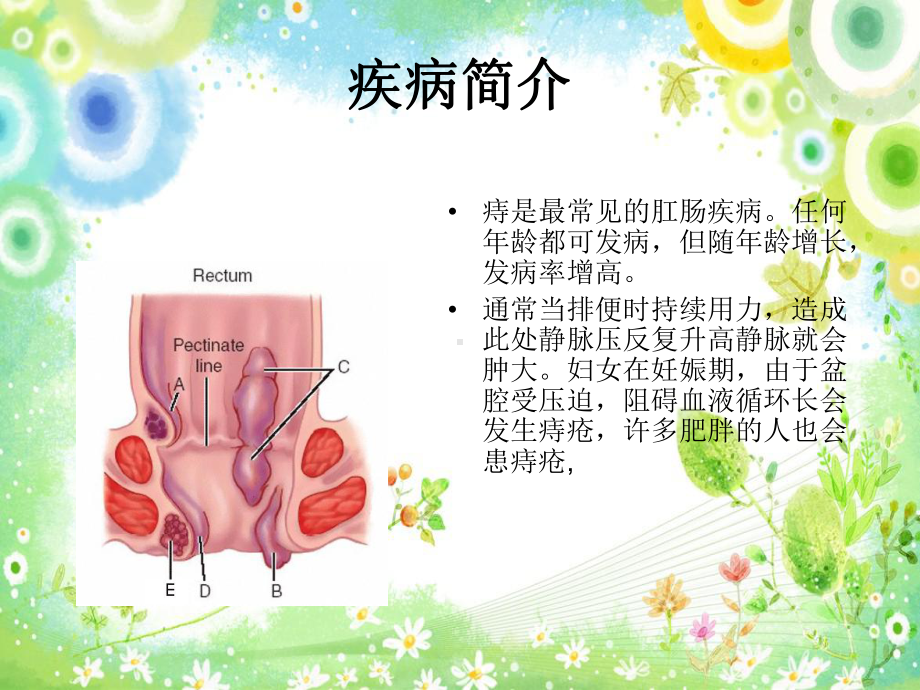 痔疮手术护理培训课件.ppt_第3页