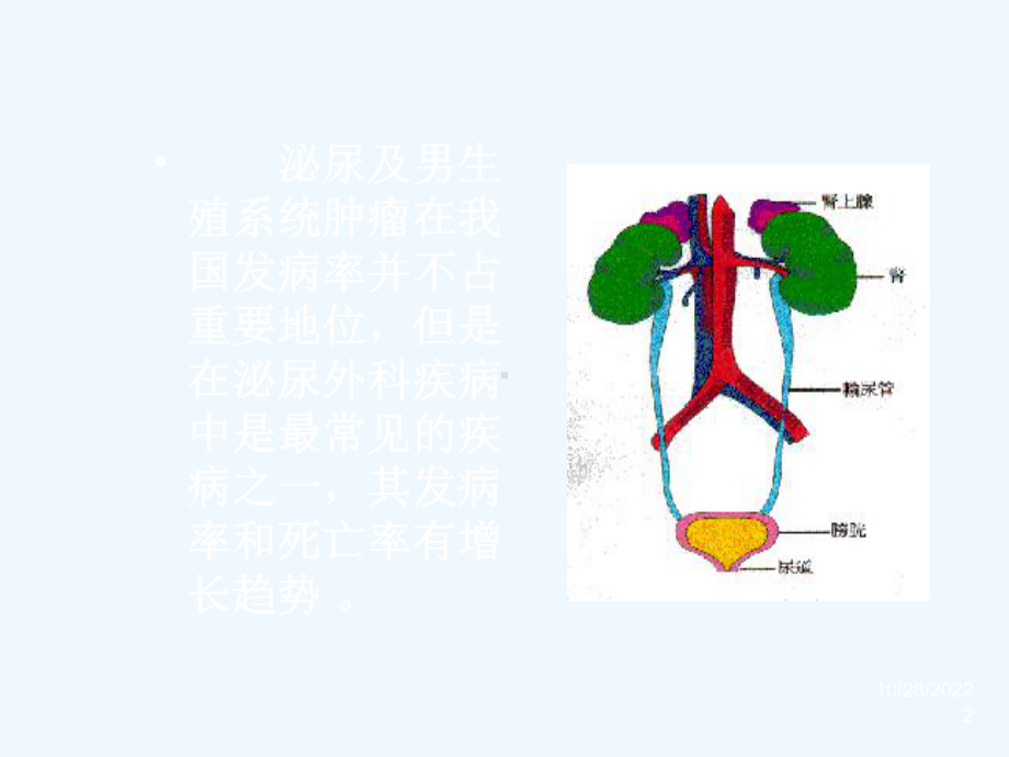 五十八讲肾肿瘤规范课件.ppt_第2页