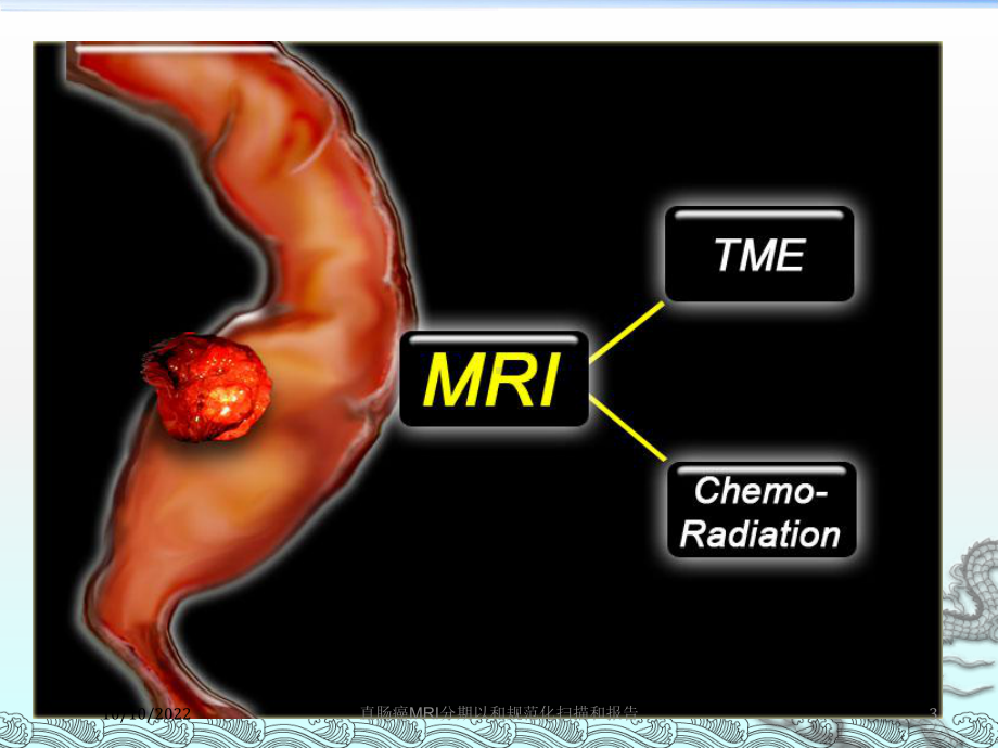 直肠癌MRI分期以和规范化扫描和报告培训课件.ppt_第3页