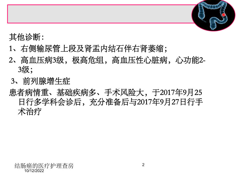 结肠癌的医疗护理查房培训课件.ppt_第2页