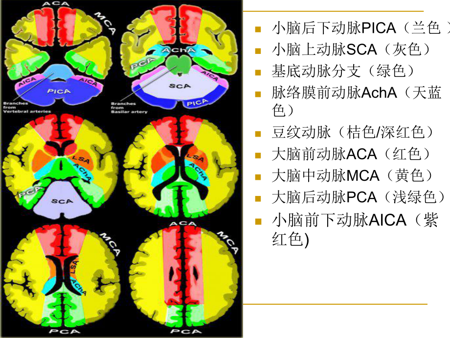 缺血性脑卒中的责任血管课件.ppt_第2页