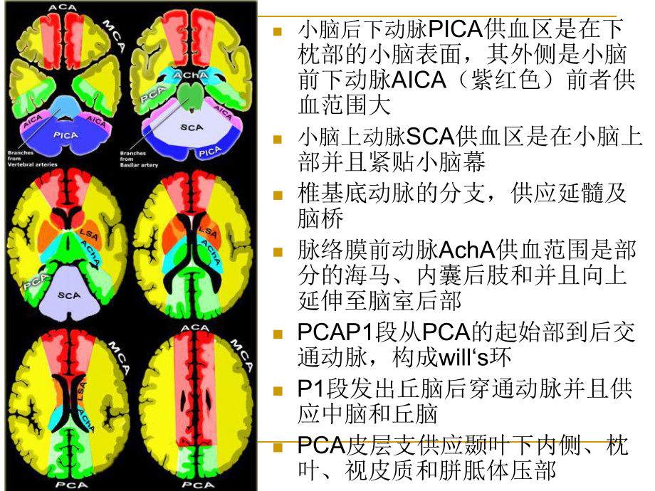 缺血性脑卒中的责任血管课件.ppt_第3页