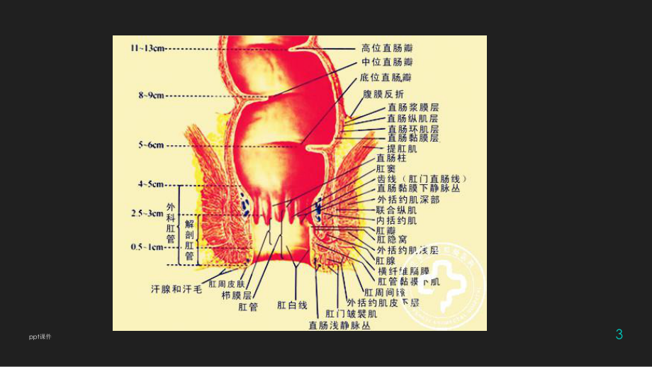 肛管解剖及常见病-课件.ppt_第3页