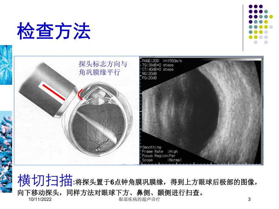 眼部疾病的超声诊疗培训课件.ppt_第3页