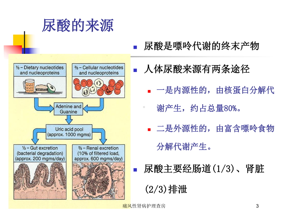 痛风性肾病护理查房培训课件.ppt_第3页