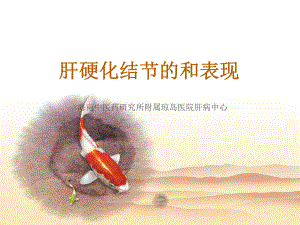 肝硬化结节的CT与MRI诊断课件.ppt