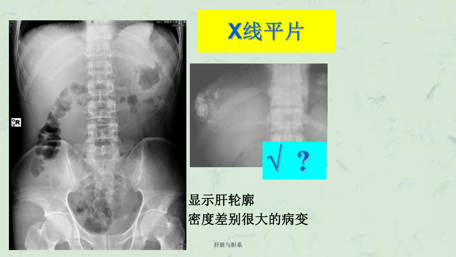 肝脏与胆系课件.ppt_第3页