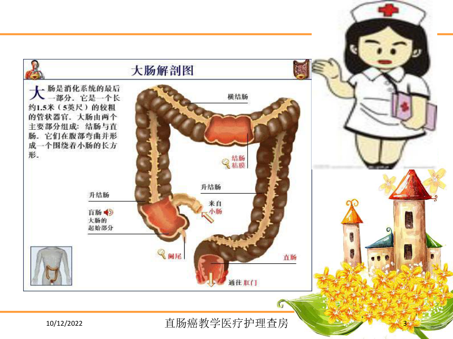 直肠癌教学医疗护理查房培训课件.ppt_第3页