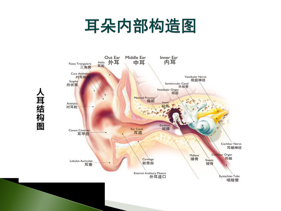 突发性耳聋的护理查房课件.pptx_第3页