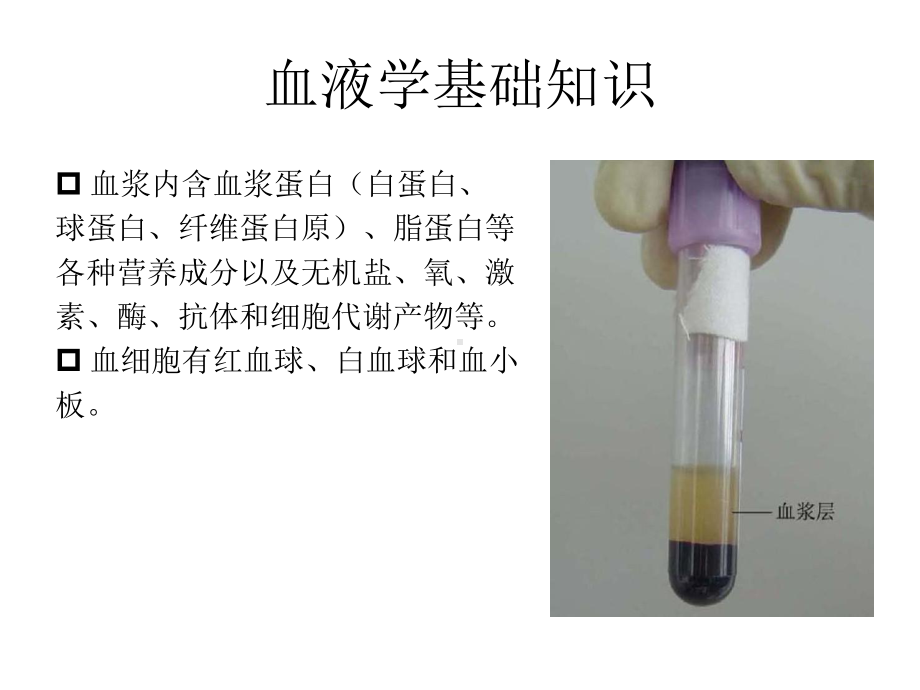 白血病基础知识课件.pptx_第3页