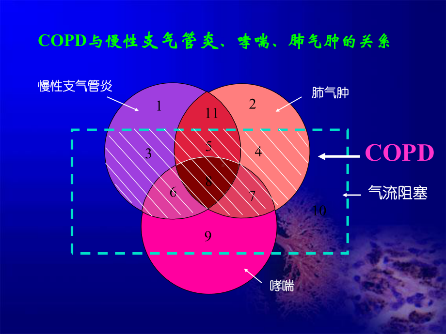 copd慢性阻塞性肺疾病-课件.ppt_第3页