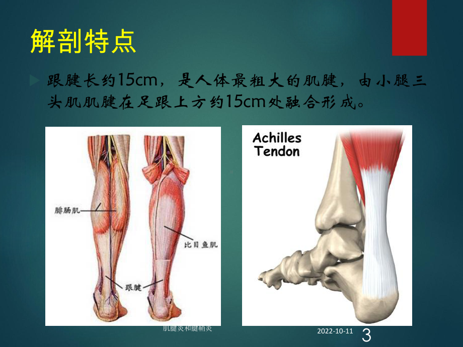 肌腱炎和腱鞘炎培训课件.ppt_第3页