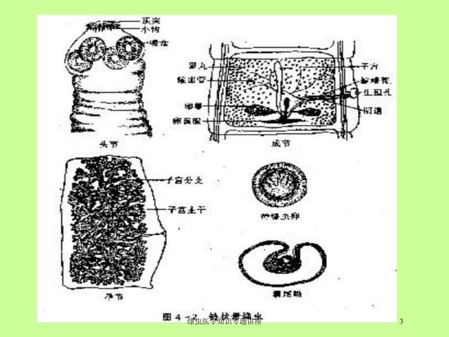 绦虫医学知识专题讲座培训课件.ppt_第3页