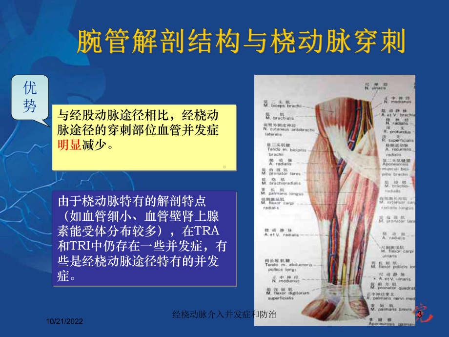 经桡动脉介入并发症和防治培训课件.ppt_第3页