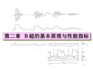 B超的基本原理与性能指标课件.ppt